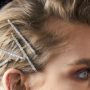 DRY SCALP