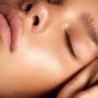 acne treatment