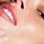 Pores