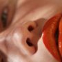 rosacea
