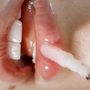 How to Make Lips Pink