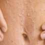 best body scrubs