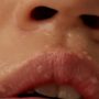 Exfoliate