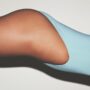 Get rid of cellulite