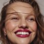 Benefits of Dental Implants